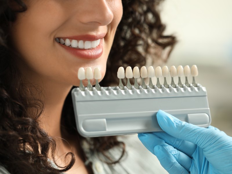 Mano con guante azul sosteniendo una guía de color dental, con la sonrisa de una mujer detrás