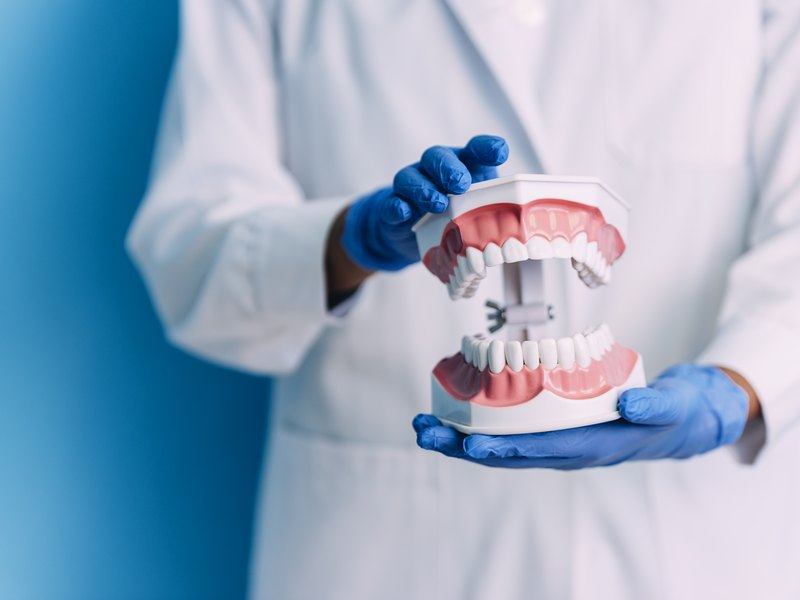 Profesional con guantes azules sosteniendo un modelo de mandíbula con dientes de muestra