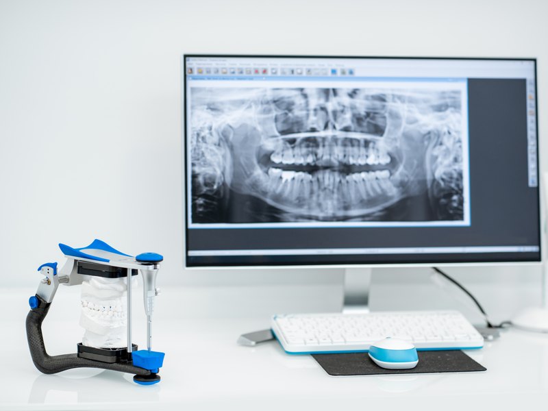 Radiografía panorámica en pantalla, con un escáner intraoral sobre la mesa