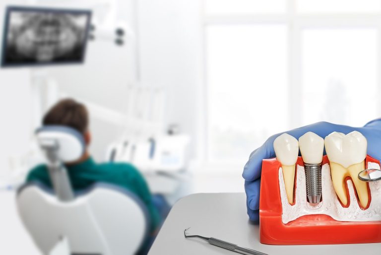 Professional showing a dental implant model, with a patient in the chair in the background