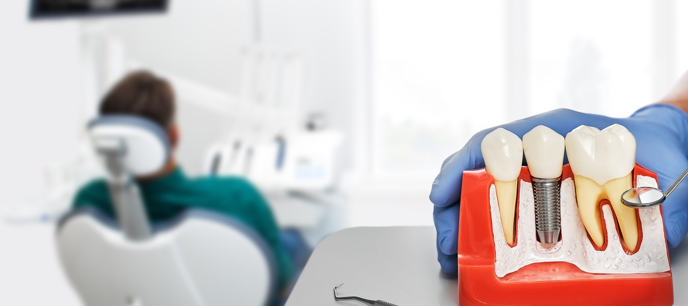 Dental implant model in the surgery, with a patient in the chair behind