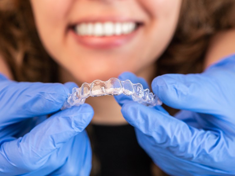 Paciente colocándose un alineador transparente de ortodoncia invisible