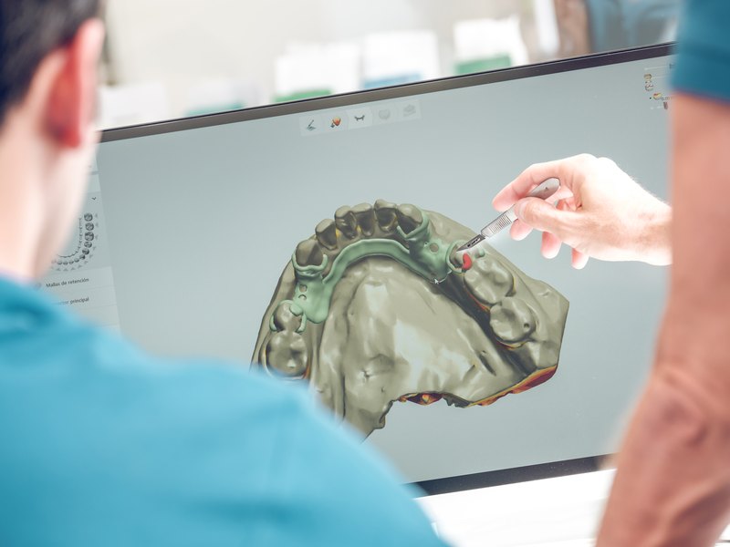 Planificación digital de la cirugía sobre el modelo 3D de la arcada en el ordenador