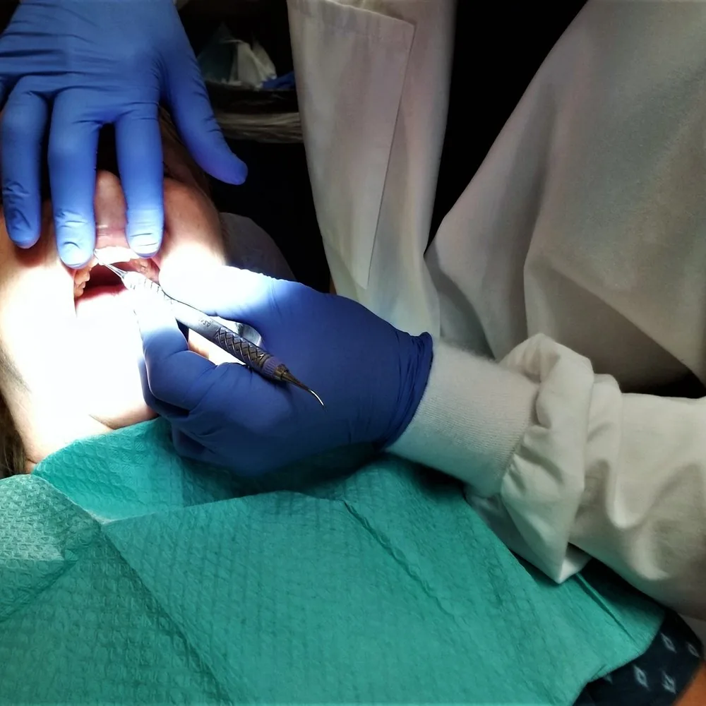 Gloved dentist working with an instrument in a patient's mouth during amalgam removal in Barcelona