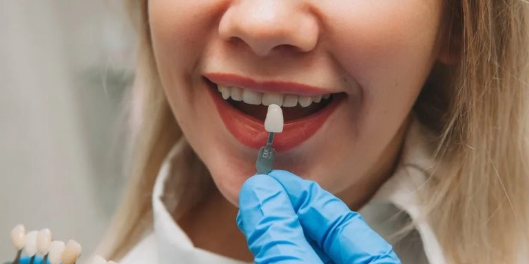 Dentista con guantes acerca una muestra de la guía de colores a los dientes de una paciente sonriente
