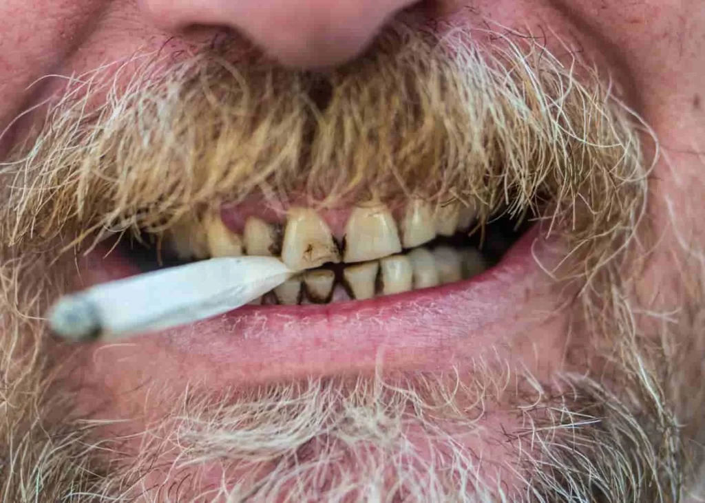 Boca de un fumador con un cigarrillo entre los dientes manchados de nicotina