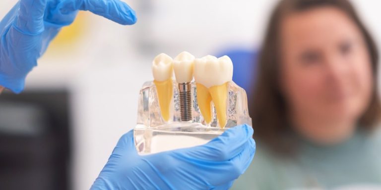 Model d'un implant amb la seva corona entre dues dents, ensenyat a una pacient a la consulta