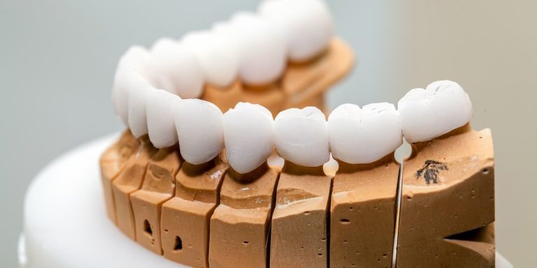 Corones dentals de ceràmica sobre un model de guix