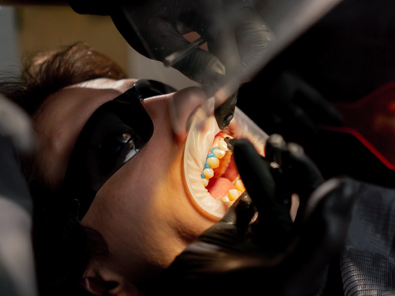 Paciente con separador de labios mientras el dentista trabaja sobre la encía superior