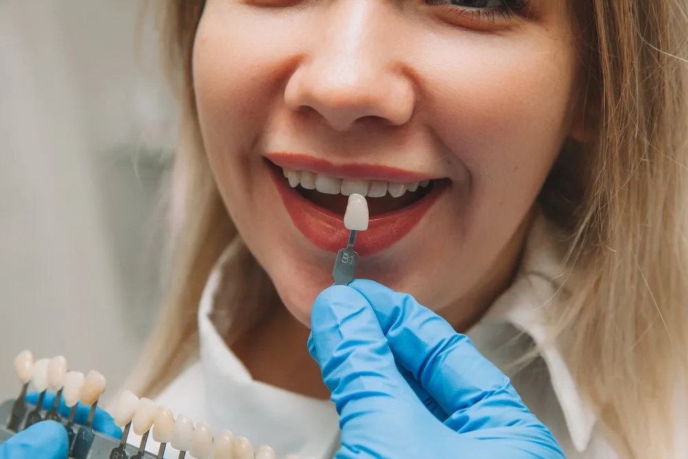 Dentista amb guants compara la mostra de color B1 amb les dents blanques d'una dona