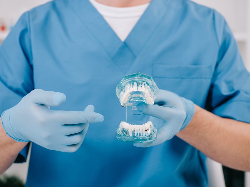 Dentista amb uniforme blau que sosté un model transparent de les arcades per explicar el desgast