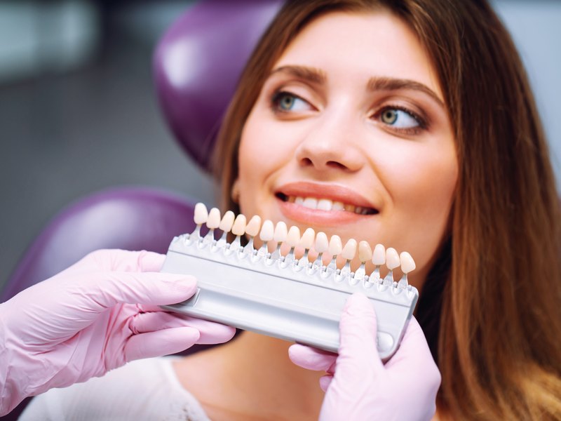 Paciente sonriendo mientras le comparan el color de los dientes con una guía de tonos