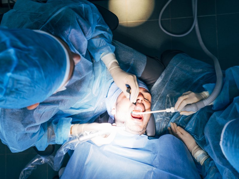 Equipo de cirugía oral extrayendo una muela del juicio a un paciente