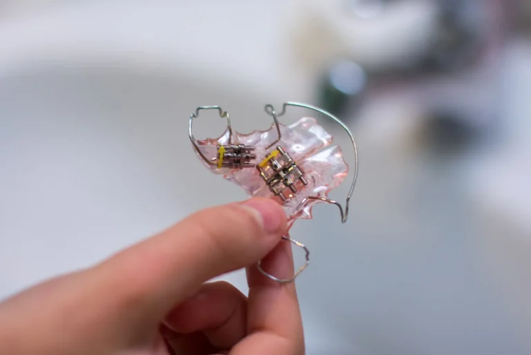 Hand holding a Hawley retainer of pink acrylic and steel wire clasps, with two expansion screws, in Barcelona