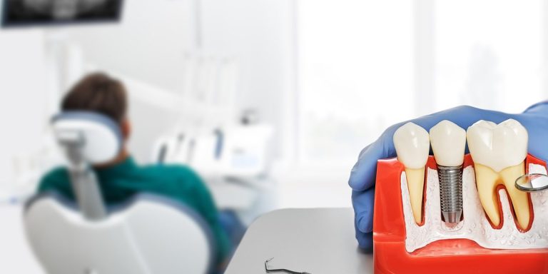 Professional ensenyant un model d'implant dental, amb un pacient a la cadira al fons