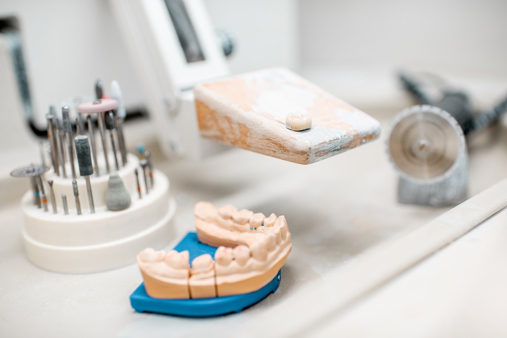 Models dentals de guix i freses sobre la taula del laboratori de pròtesis