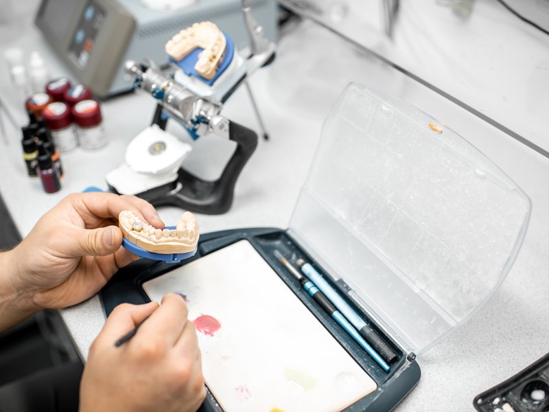 Muntatge de la pròtesi sobre el model amb l'articulador al laboratori