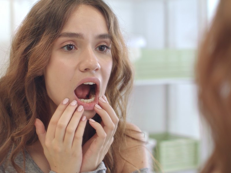 Mujer joven ante el espejo separándose el labio para mirarse el interior de la boca