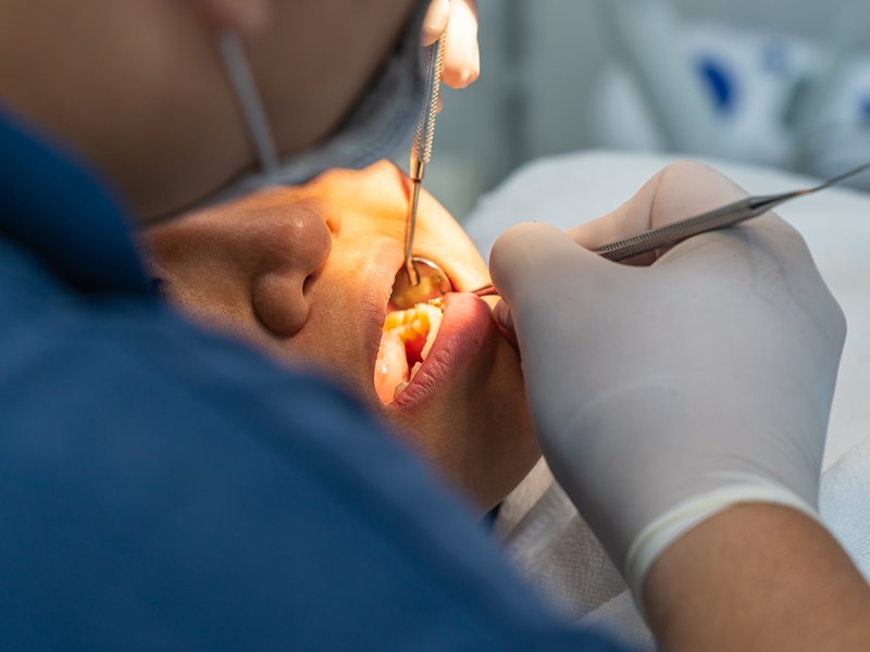 Reconstrucció dental