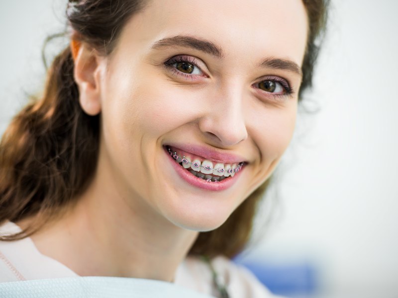 Dona somrient amb brackets metàl·lics a les dents
