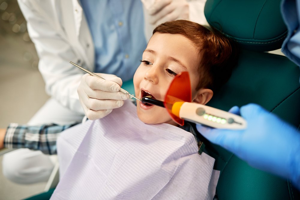 Dental sealants