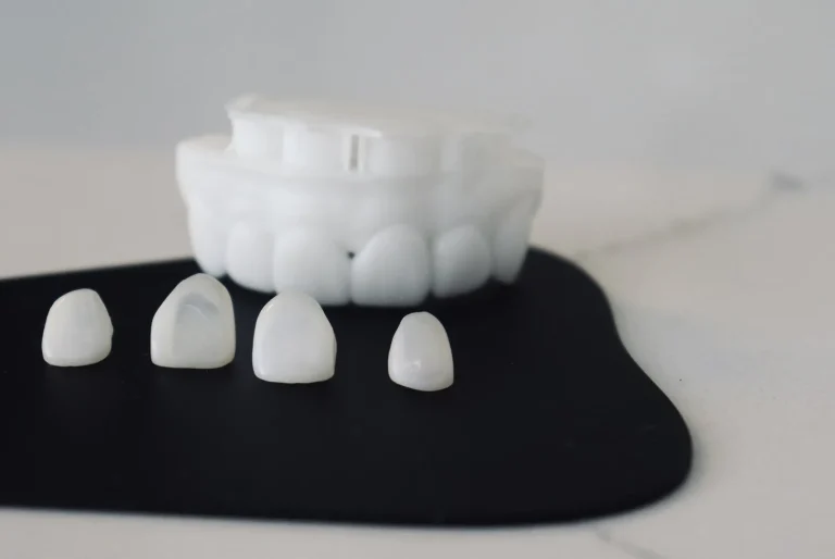 Cuatro carillas de cerámica sobre un tapete negro ante un modelo de dientes: precio de las carillas dentales en Barcelona