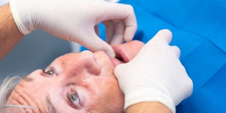 Dentista con guantes separa el labio de un paciente mayor recostado en el sillón para revisarle las encías