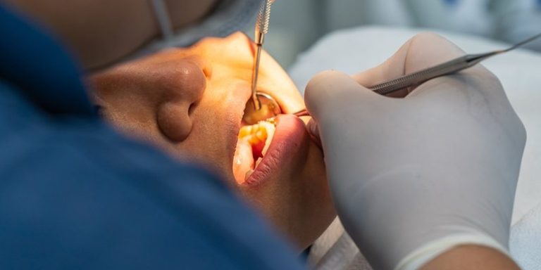 Dentista revisando un diente con espejo y sonda antes de reconstruirlo