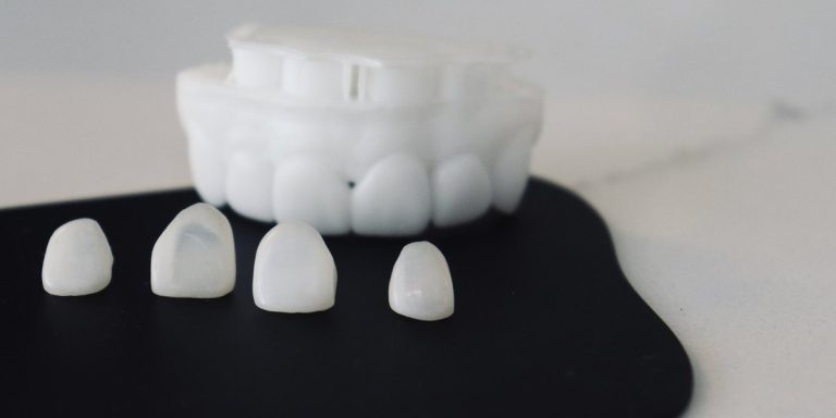 Carilles dentals de disilicat de liti al costat d'un model de l'arcada superior