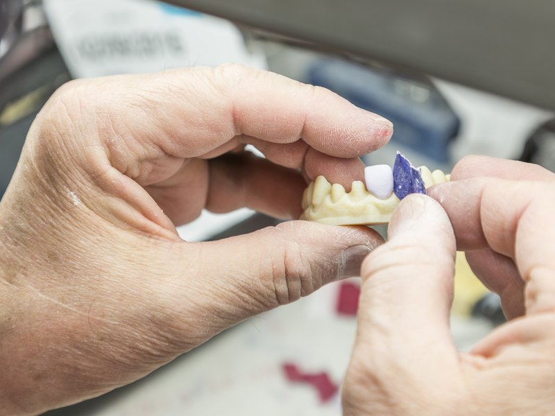 Tècnic protètic que col·loca una dent sobre el model de guix