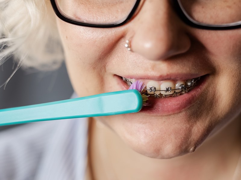 Dona que es raspalla les dents amb un raspall de cerres suaus