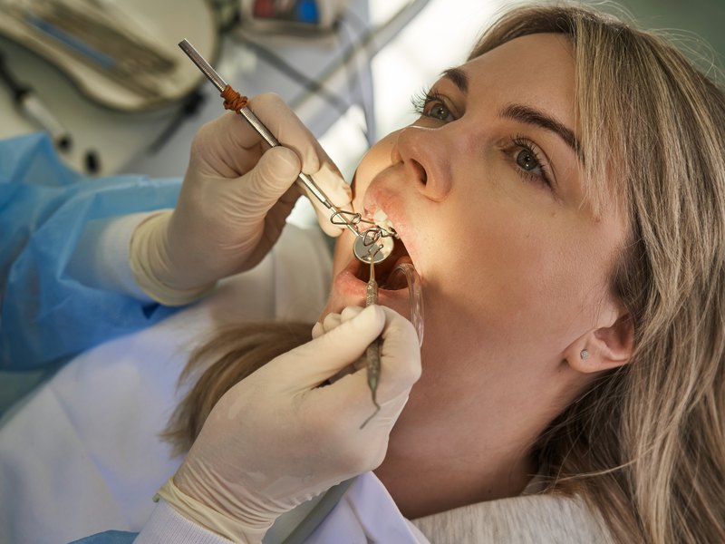 Reconstrucció d'una dent d'una pacient amb l'instrumental a la consulta